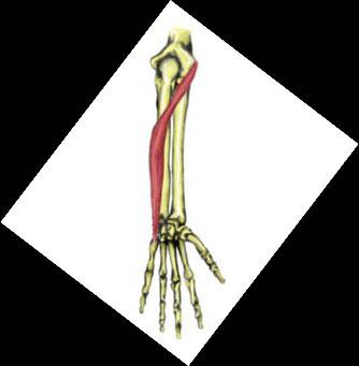 <p>origin: medial epicondyle of humerus and ulna<br>insertion: base of metacarpal 5<br>action: extension and adduction at wrist</p>