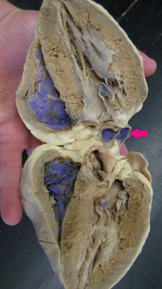 <p>Identify the valve.</p>