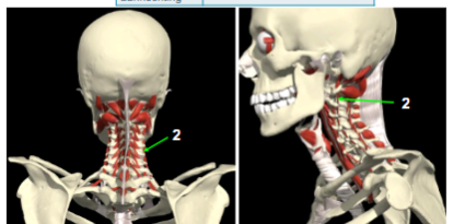 <p><span>mm. intertransversarii cervicis posteriores (2) (deel van Mm. Intertransversarii) </span></p>
