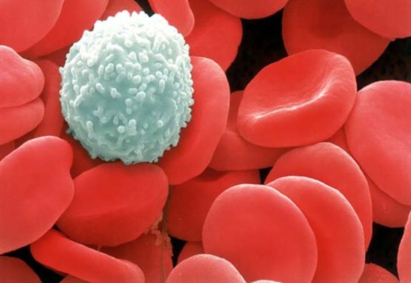 <p>Blood cells that perform the function of destroying disease-causing microorganisms</p>