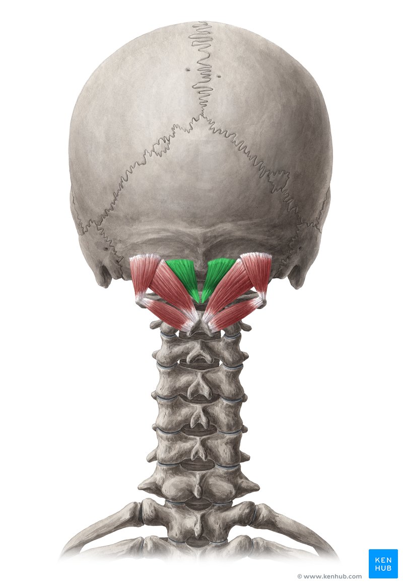 <p>Rectus Capitis Posterior Minor (Intrinsic Back Deep Muscle) [Suboccipital Muscles]</p><p>Origin?</p><p>Insertion?</p><p>Action?</p><p>Innervation?</p>