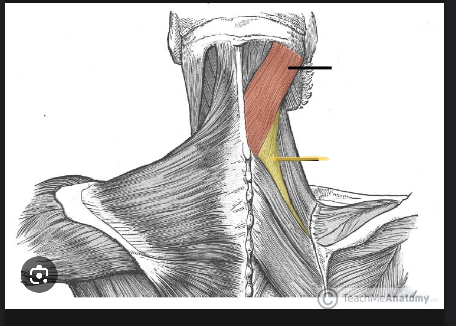 <p>Identify the highlighted muscle</p>