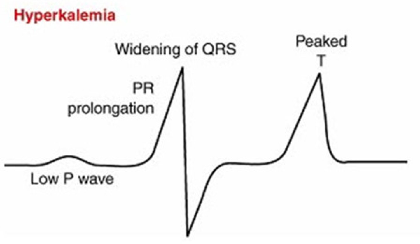 <p>life threatening cardiac arrhythmias, management - cardiac monitoring, administration of insulin + glucose, calcium gluconate, loop diuretics or dialysis, restrict potassium intake.</p>
