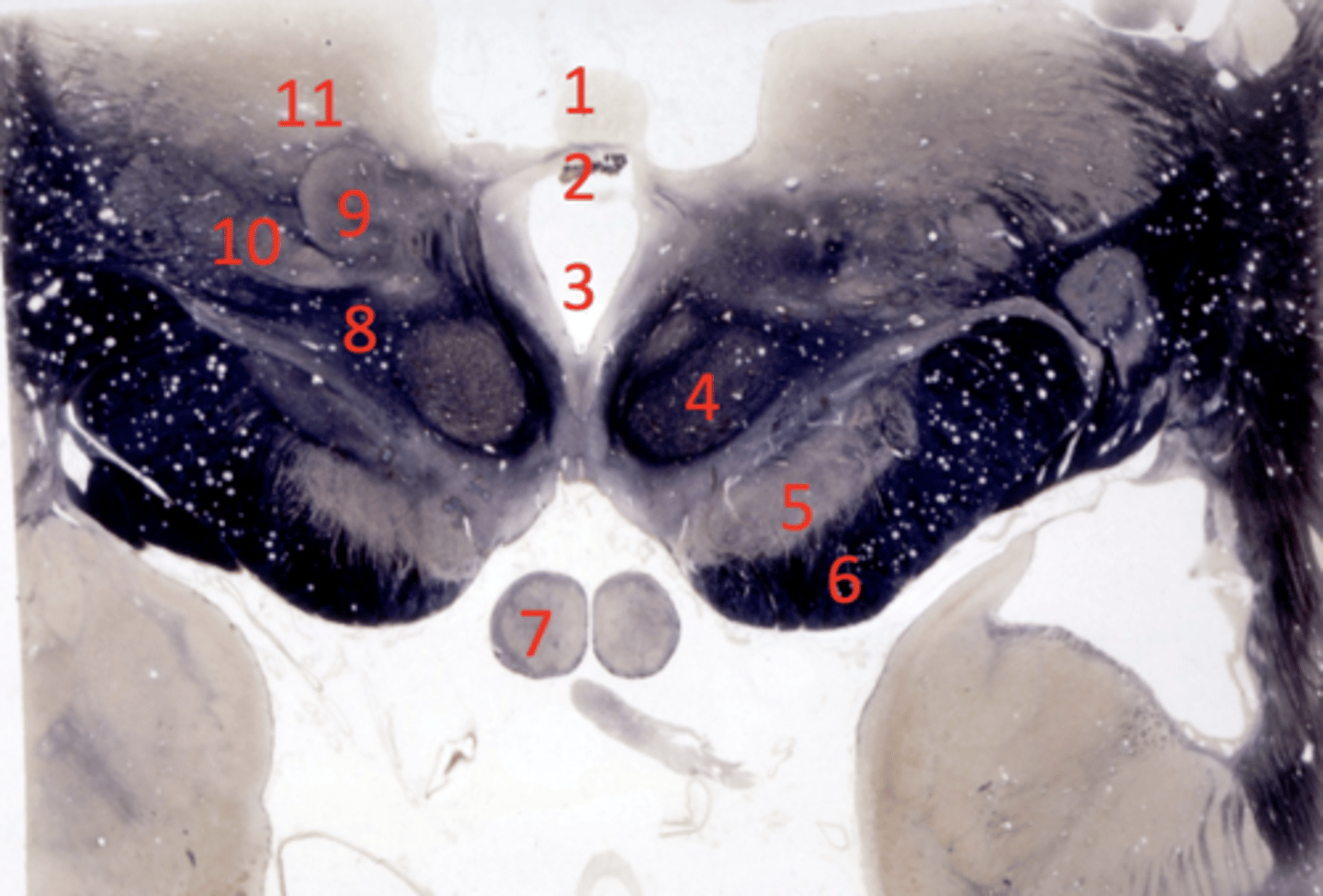 <p>lateral geniculate</p>