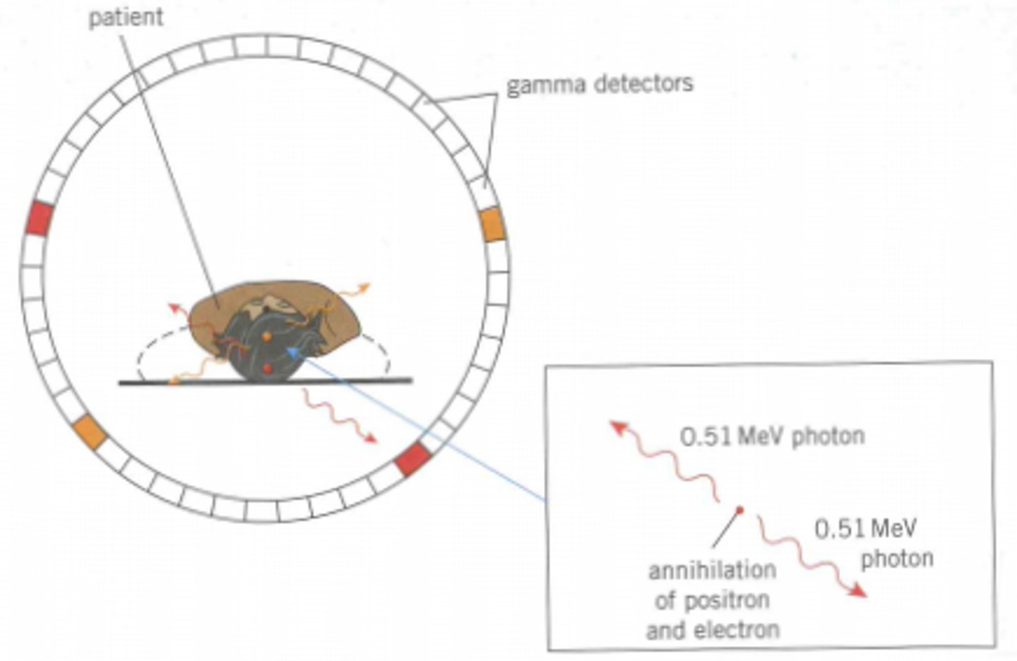 <p>- patient lies on a table</p><p>- surrounded by a ring of gamma detectors</p><p>- each detector consists of a photomultiplier tube and a sodium iodide scintillator and produces an electrical signal for ever gamma photon incident at its scintillator</p><p>- detectors are connected to a high-speed computer</p>