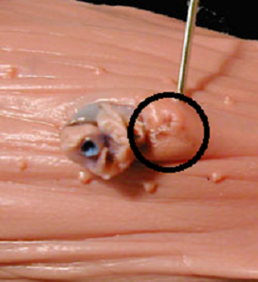 <p>A small mound just posterior to the umbilical cord on the ventral side</p>