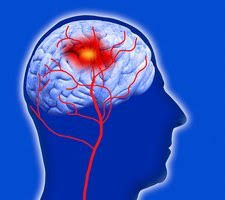 <p><strong>Which of the following diagnostic findings is likely to result in the most serious brain insult?</strong></p><p>A) Mean arterial pressure (MAP) that equals intracranial pressure (ICP)</p><p>B) Moderate decrease in brain tissue volume secondary to a brain tumor removal</p><p>C) Increased ICP accompanied by hyperventilation</p><p>D) High intracellular concentration of glutamate</p>