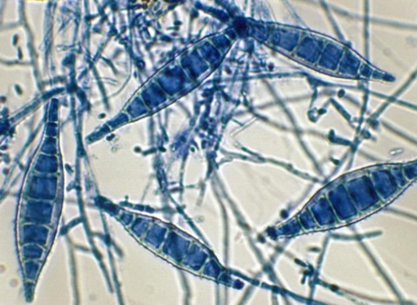 <p>• Skin and scalp infections</p><p>usually from pets</p><p>• Colony surface is white</p><p>with yellow edges</p><p>• Spindly, rough</p><p>macroconidia with >6</p><p>cells</p>