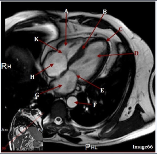 <p>Letter B is pointing to </p>