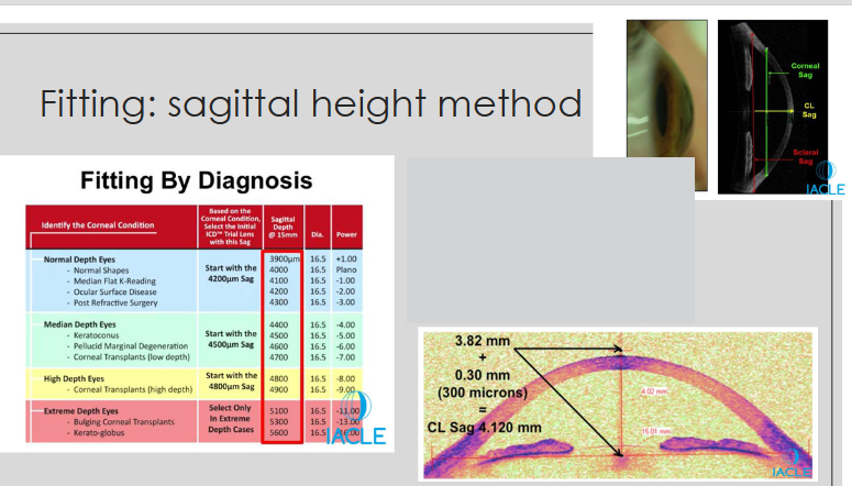<ul><li><p>Determine the anterior eye’s sagittal height for:</p><ul><li><p>the chord length at 15.0 mm (for a 16.5 mm TD scleral lens)</p></li></ul></li><li><p>Add 0.30 mm (300 μm) to that sagittal height to select the lens</p></li></ul><p></p>