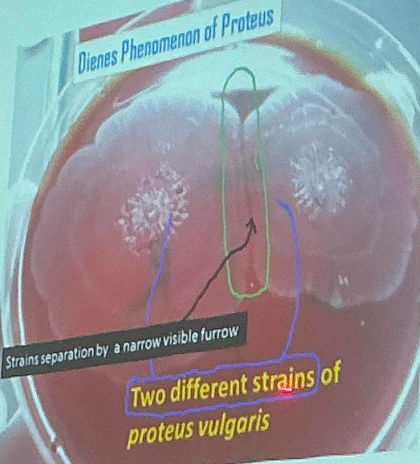 <p>When two strains of Proteus are inoculated at different areas on a culture plate:</p><ul><li><p>›If swarming of two strains merge incompletely, and remain separatby a narrow line of demarcation- indicates two strains are different.</p></li><li><p>›If swarming of two strains merge completely without any line ofdemarcation-indicates two strains are identical.</p></li></ul><p></p>