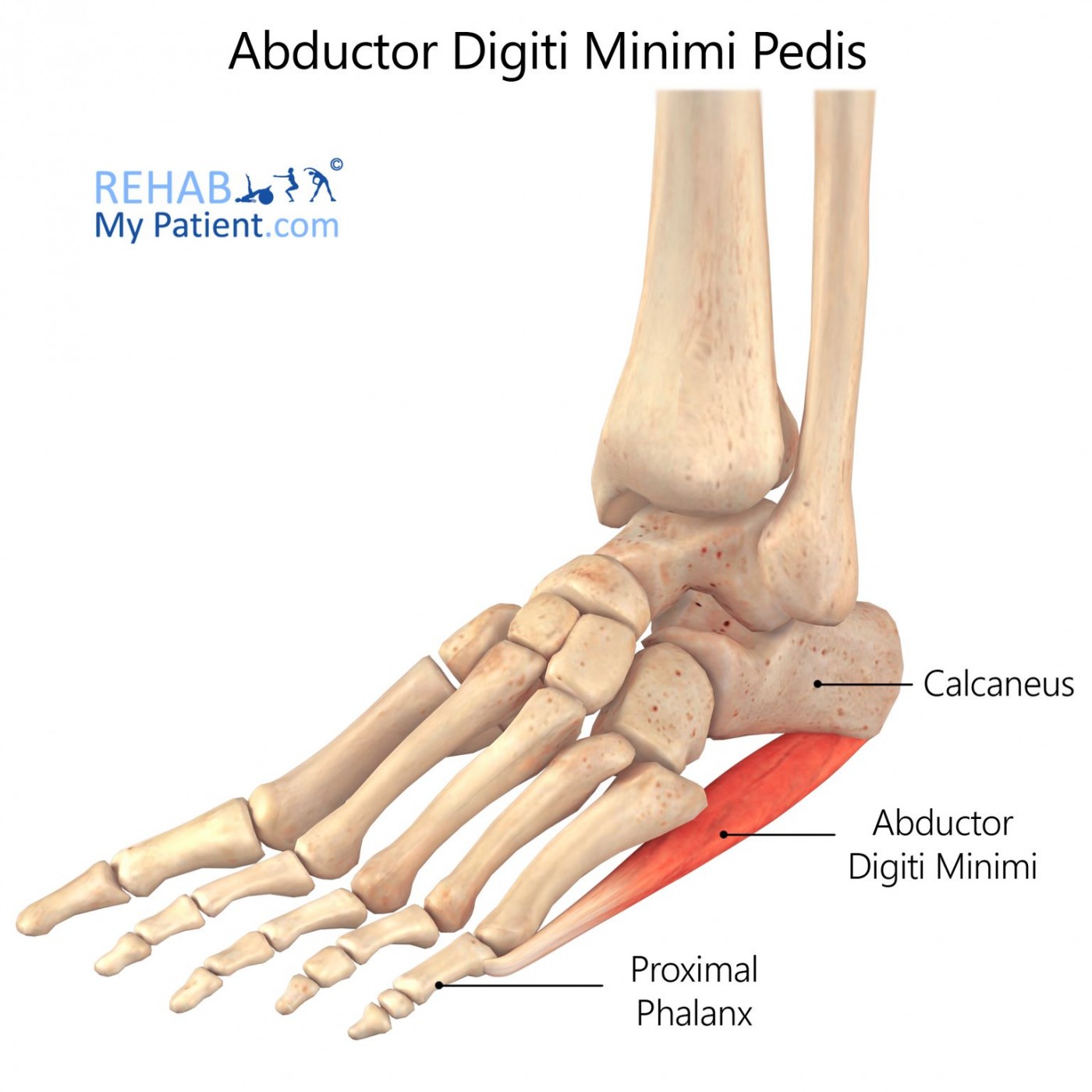 Abduction of the MTP (toe 5)