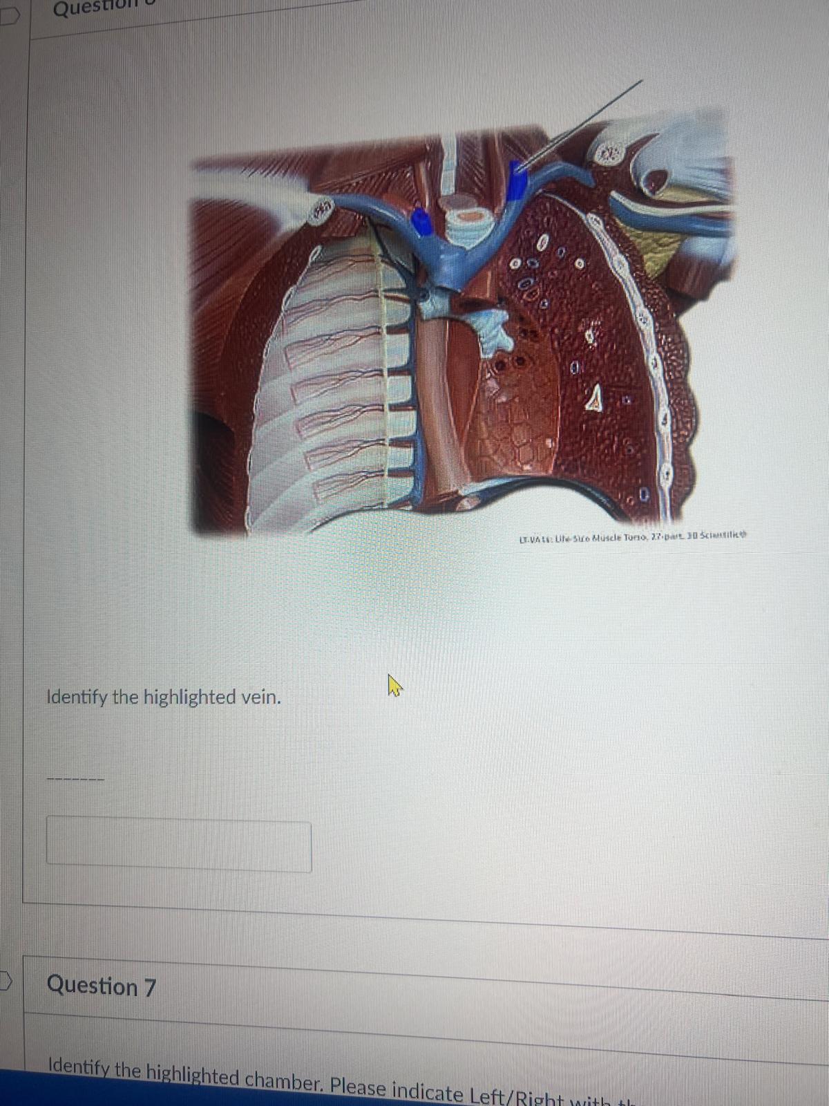 <p><span>Identify the highlighted vein.</span></p>