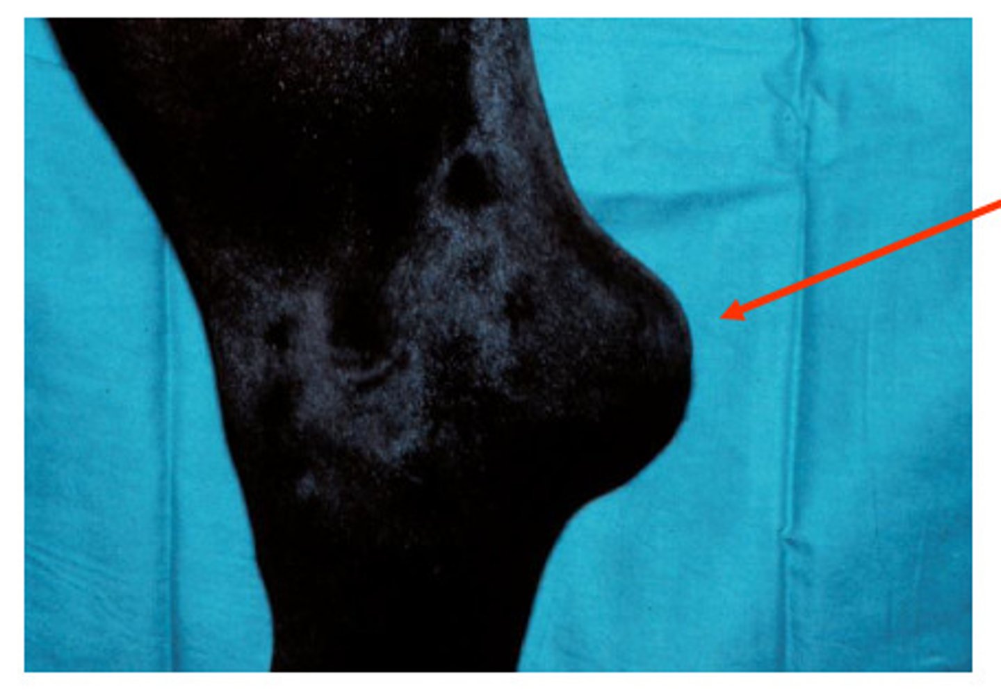 <p>Traumatic bursitis of the hock --&gt; enlargement</p><p>Caused by bruising</p><p>TX: Tincture of iodine to reduce size</p>
