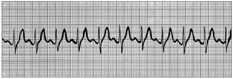 <p>(rate is too fast)</p>