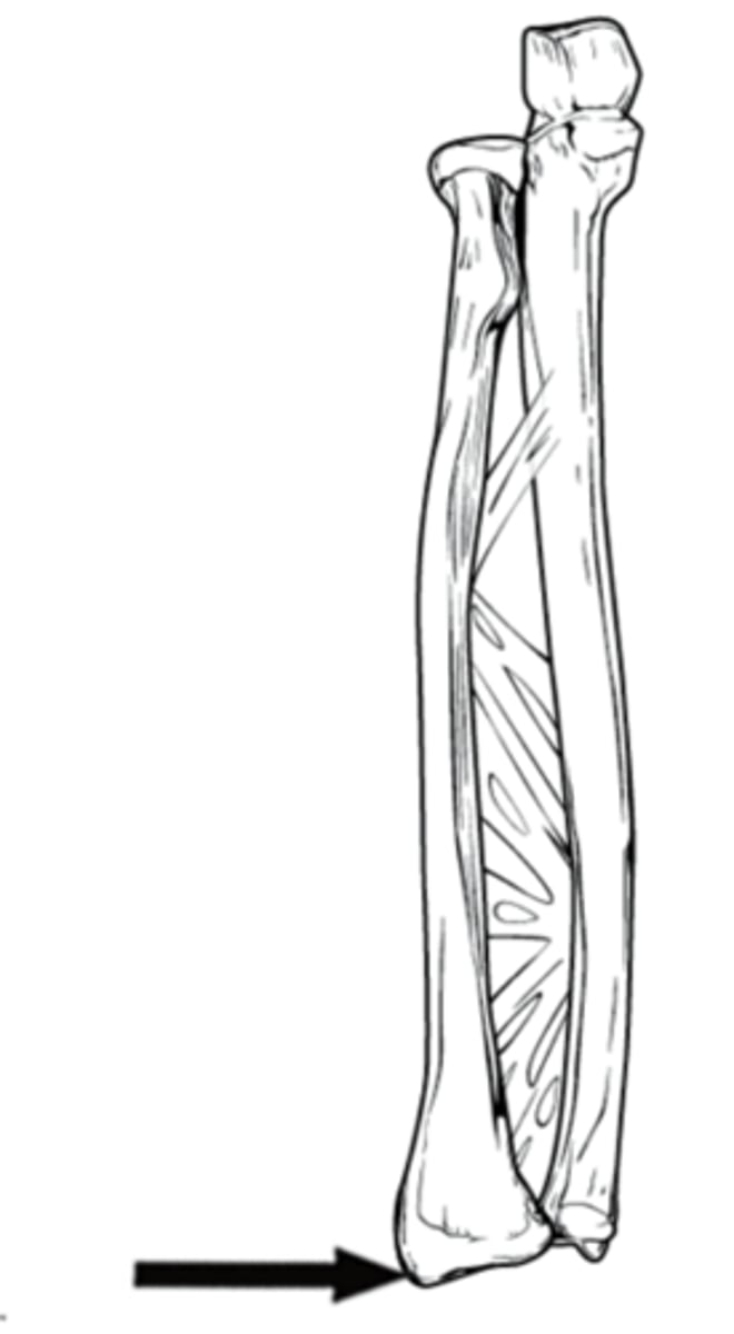 <p>a sharp, wedge-shaped projection on the lateral (thumb-side) distal end of the radius bone</p>