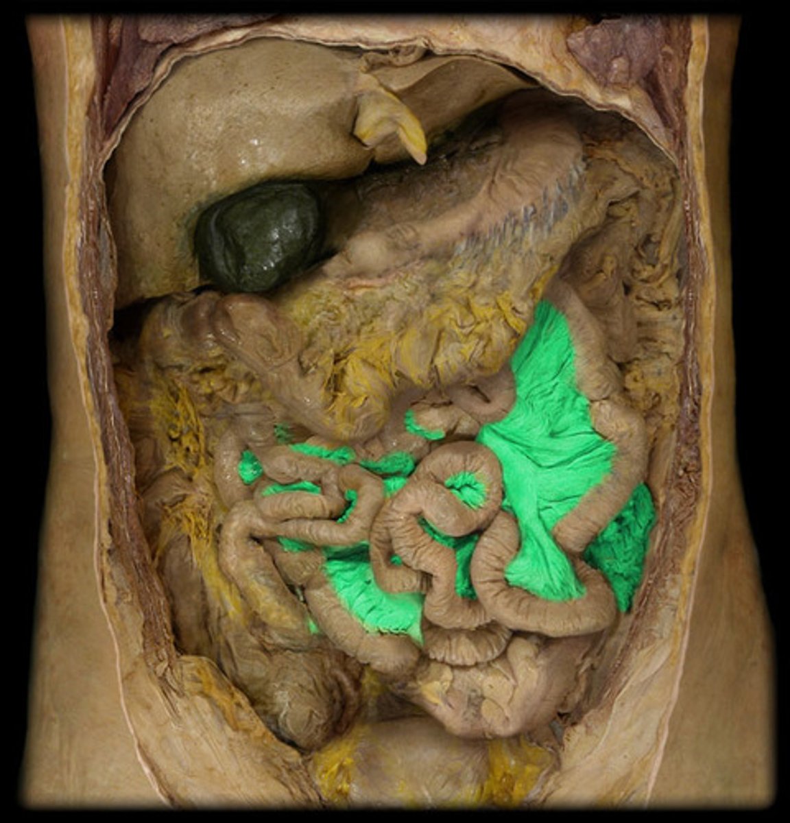 <p>attaches intestines to the posterior abdominal wall and is formed by the double peritoneum</p>