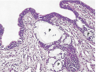 <p>pseudostratified columnar to stratified epithelium, becoming stratified squamous epithelium in the glans near the tip of the pp </p>