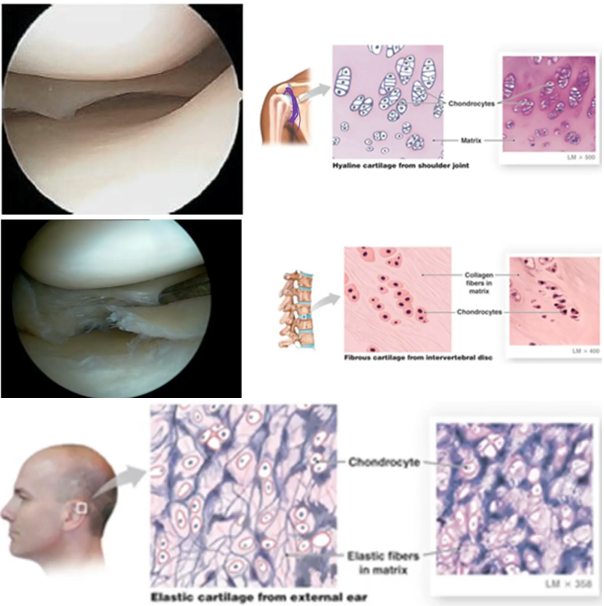 <p>3 types of cartilage can be found in the human body:</p><ul><li><p><strong>Hyaline cartilage</strong> - <strong>shiny</strong>, <strong>smooth</strong>, <strong>white type</strong> of cartilage that is the most abundant type of cartilage in the <strong>body</strong>. This type of cartilage is <strong>flexible but relatively weak</strong></p></li><li><p><strong>Fibrocartilage</strong> - a <strong>very strong and rigid type</strong> of cartilage. The many <strong>thick collagen fibres</strong> present give it these properties</p></li><li><p><strong>Elastic cartilage</strong> - somewhat <strong>rigid, yet flexible and elastic</strong>. The elastic fibres present give it these properties</p></li></ul><p></p>