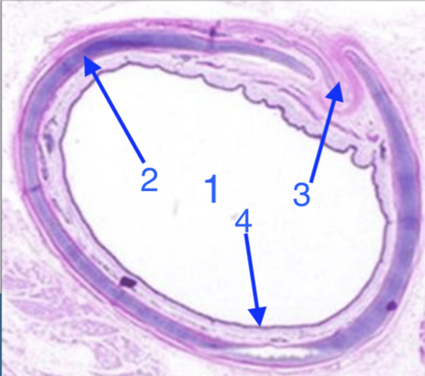 <p>what is 3?</p>