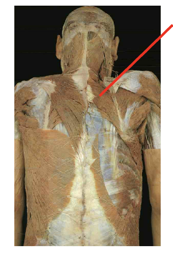 <p>What is this muscle.&nbsp;What is its origin. Where does it inserts. </p>