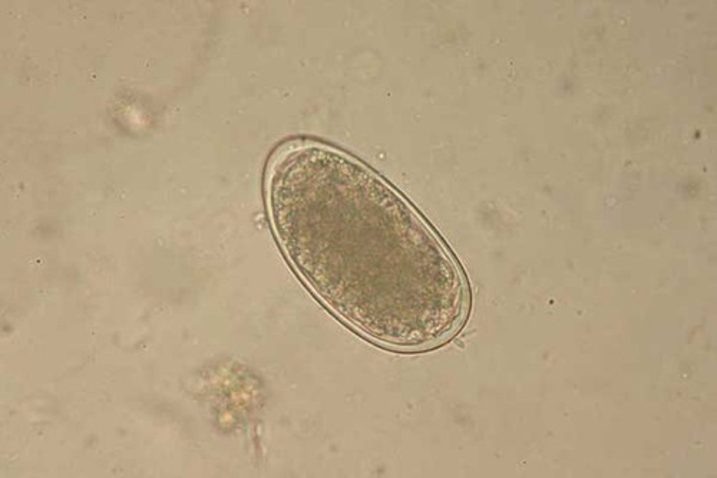 <p>canine and feline hookworm</p>