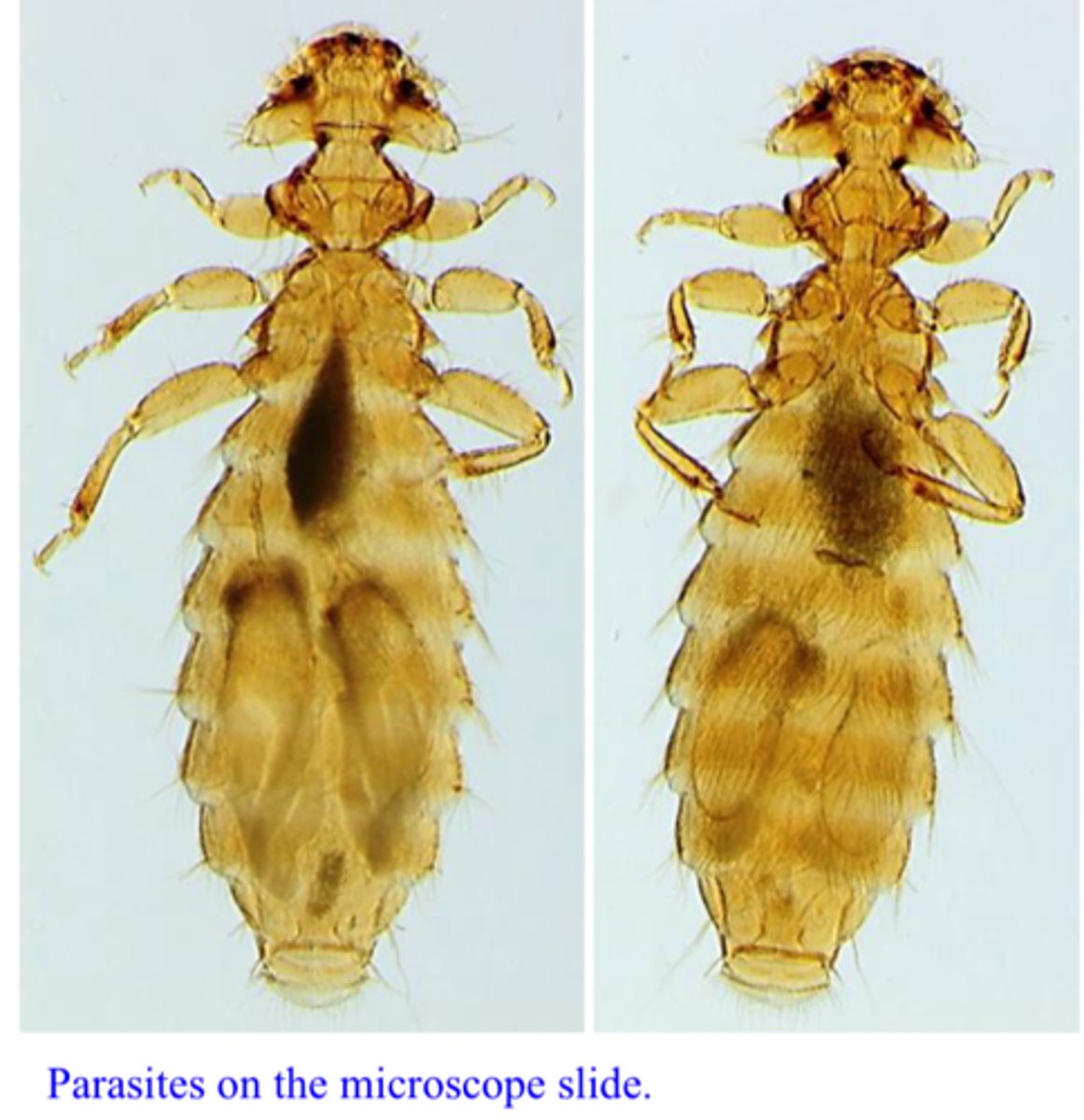 <p>Station 6:</p><p>Q1: Name the parasite/group of parasites (and the particular species).</p>