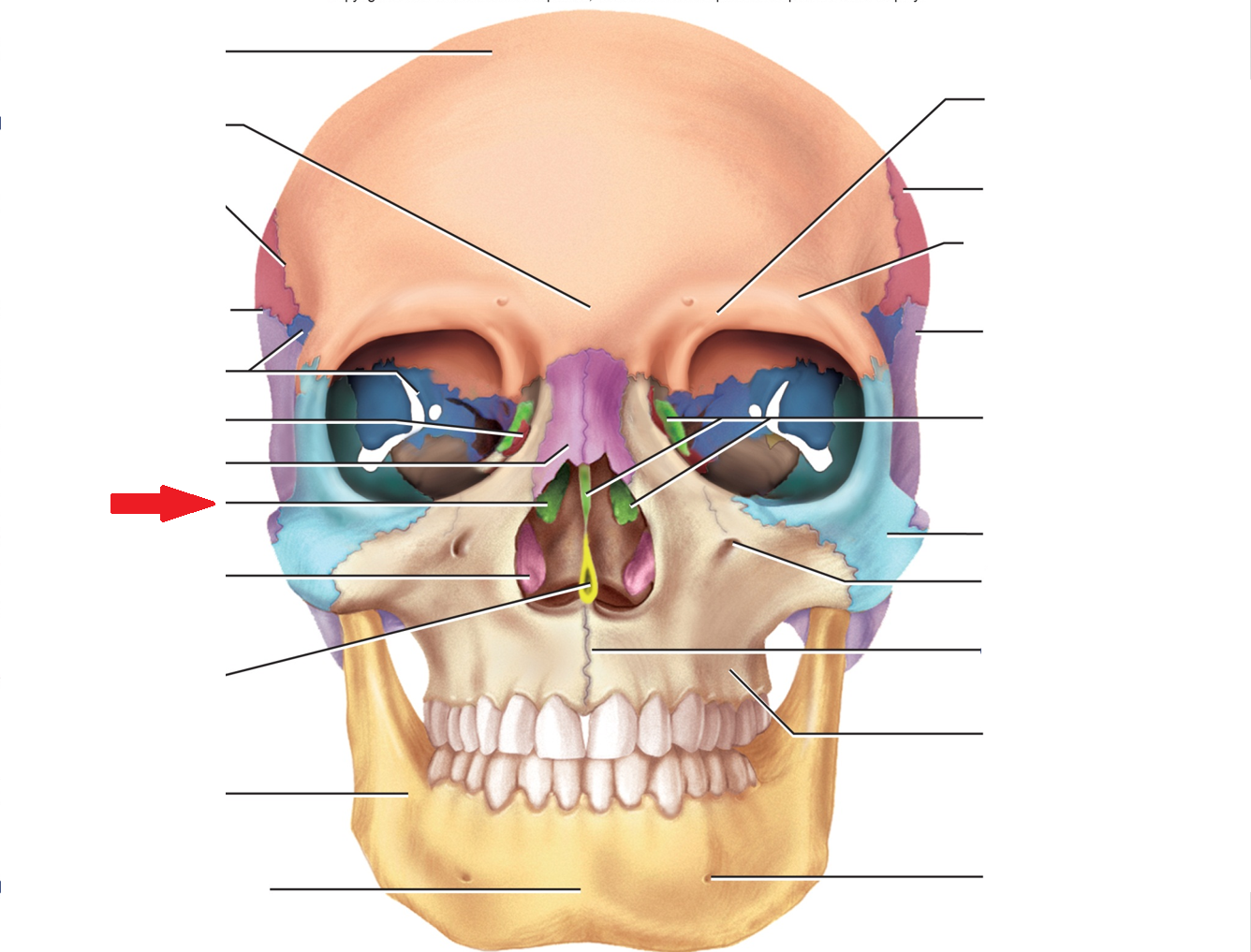 term image