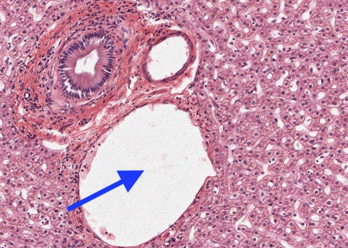 <p><span>The circular structure (X10) whose lumen is arrowed is a</span></p>