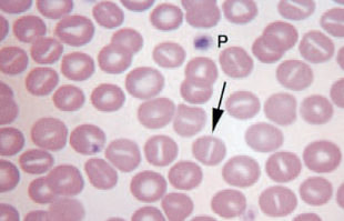 <ul><li><p>transverse fold across center of cell</p></li><li><p>clear slit-like pale region in center</p></li><li><p>is an artifact if slit is perpendicular to feathered edge </p></li></ul><p></p>