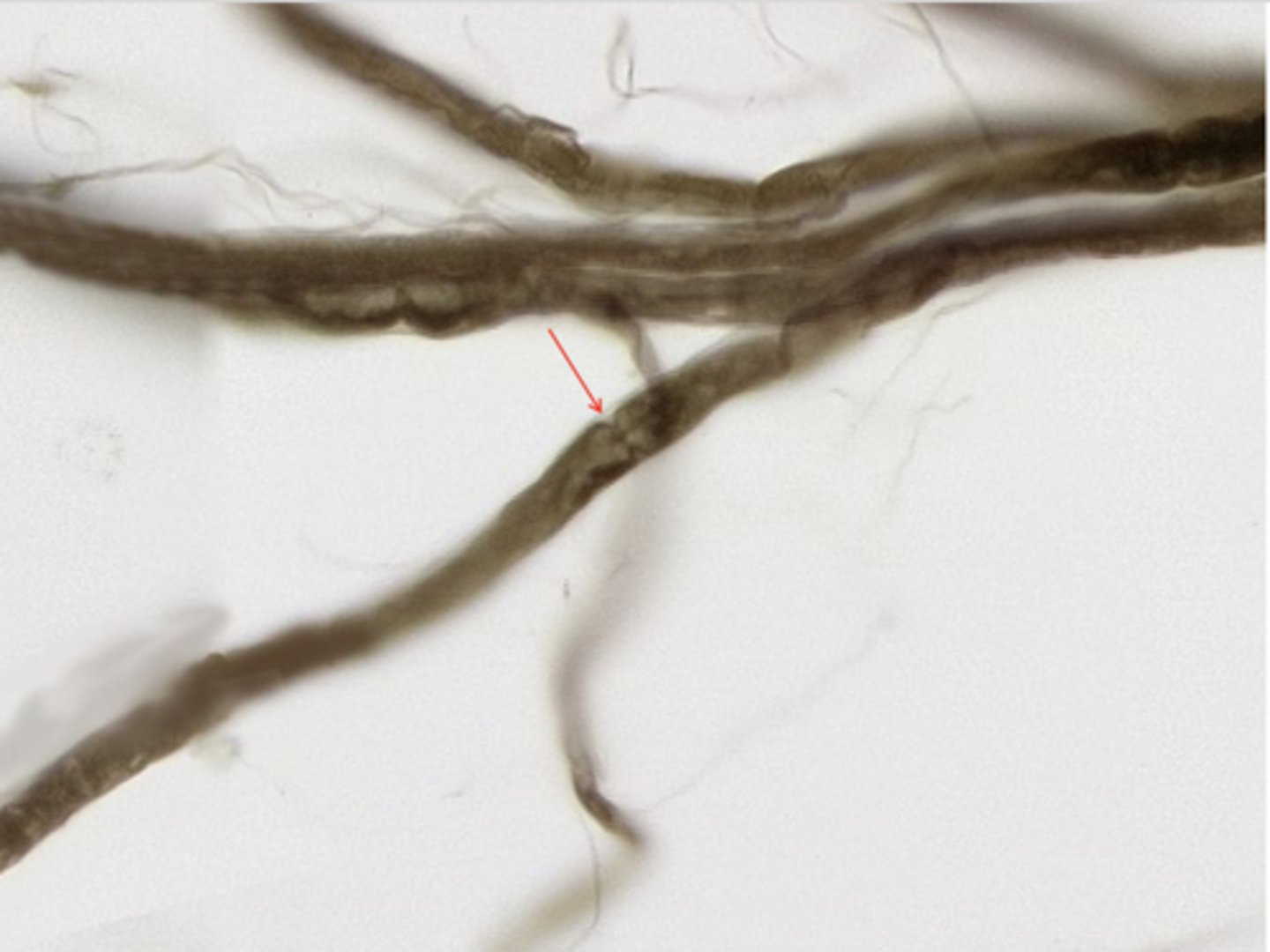 <p>Identify the structure</p>
