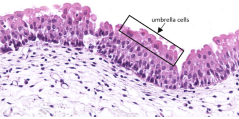 <p>What organ specimen is shown in this slide?</p>