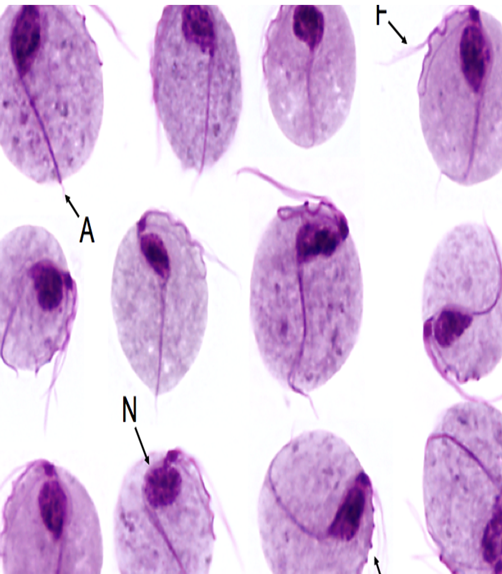 <p><span><span>Trichomonas vaginalis</span></span><br><span><span>Stage: trophozoite</span></span></p>