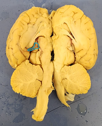 Name the structure (Black Stuff)