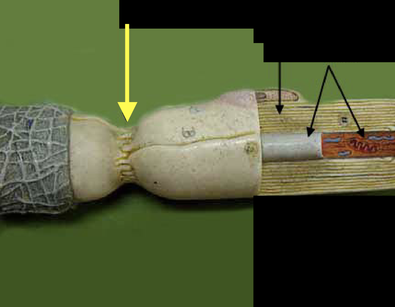<p>What part of the neuron is this?</p>