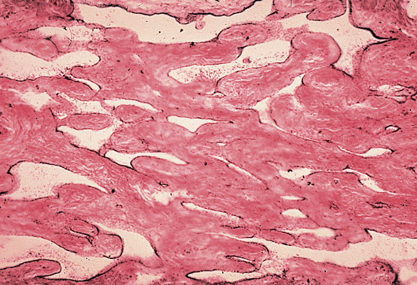 <p>Rete testis</p><ul><li><p>Appears like a “flattened sponge”</p></li></ul><p></p>