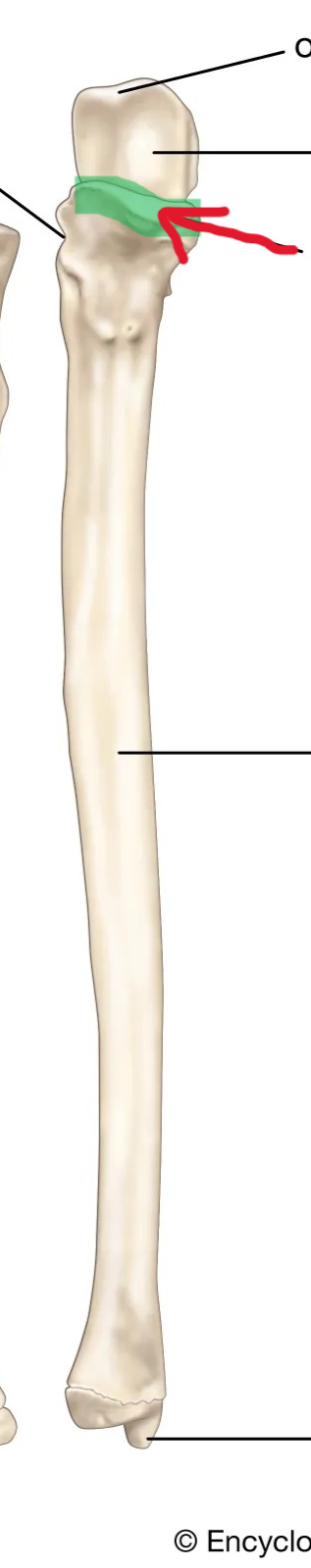 <p>What part of the ulna is this?</p>