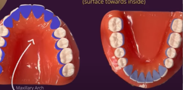 <p>side of teeth facing tongue</p>