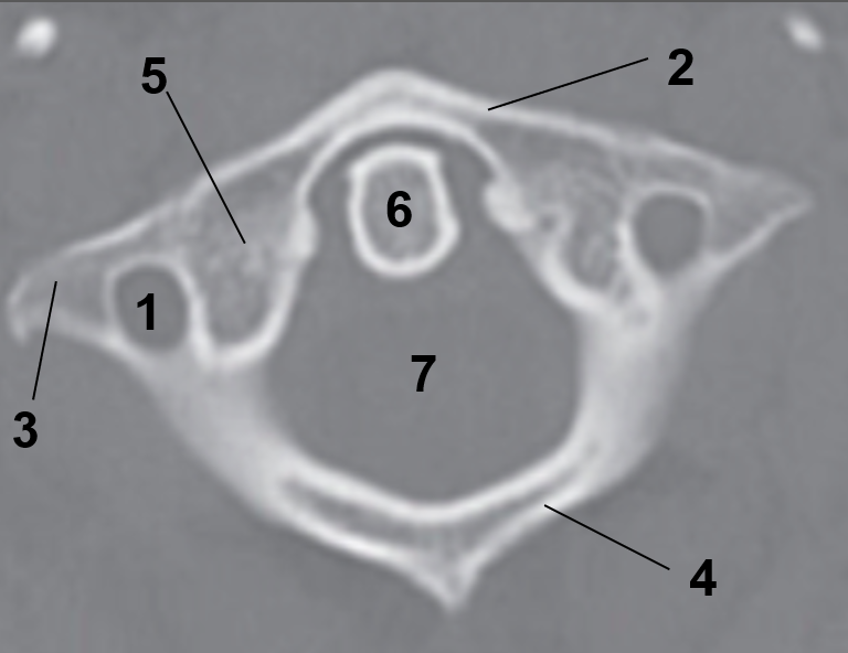 <p>5</p>