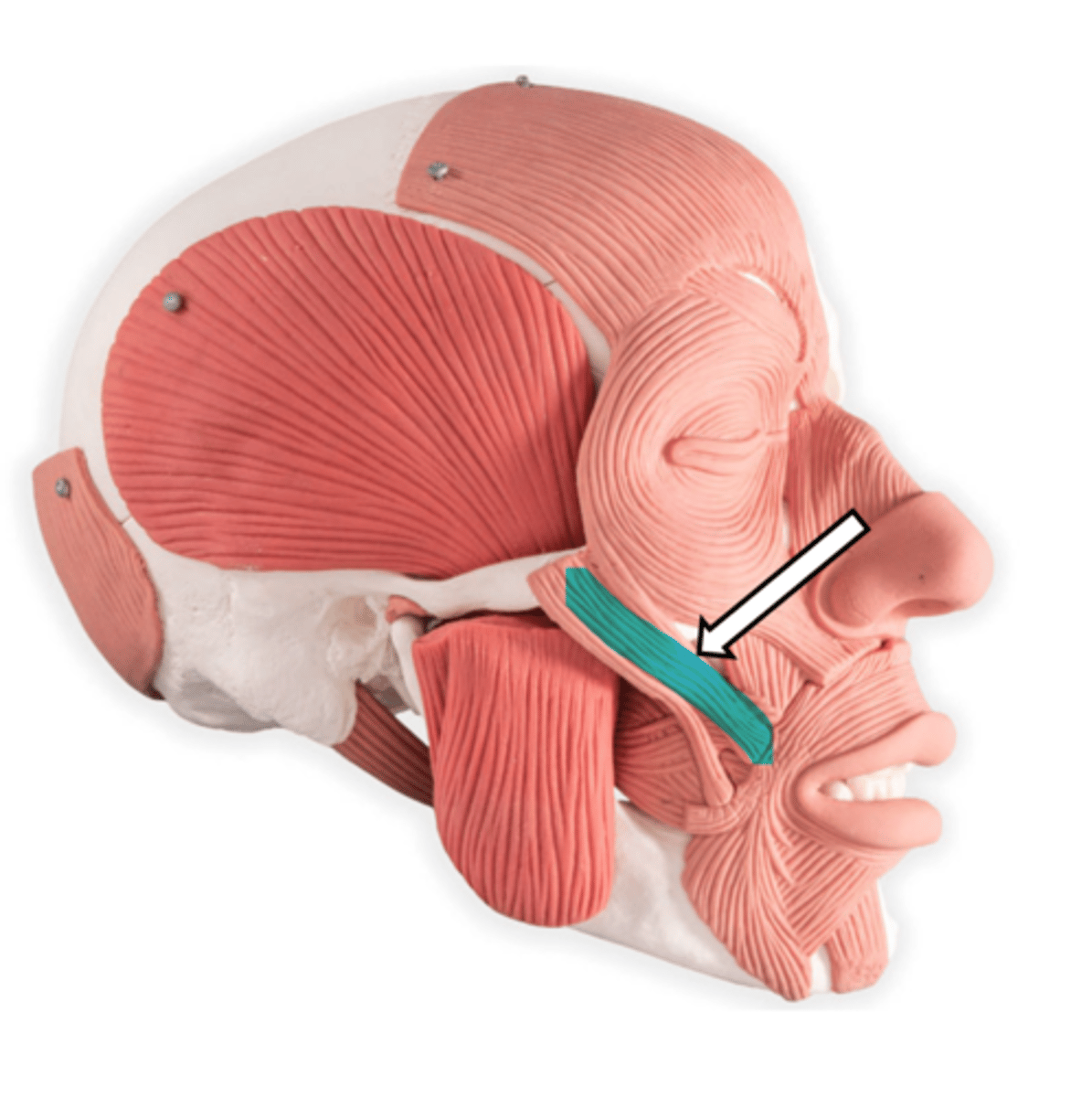 <p>name the muscle</p>