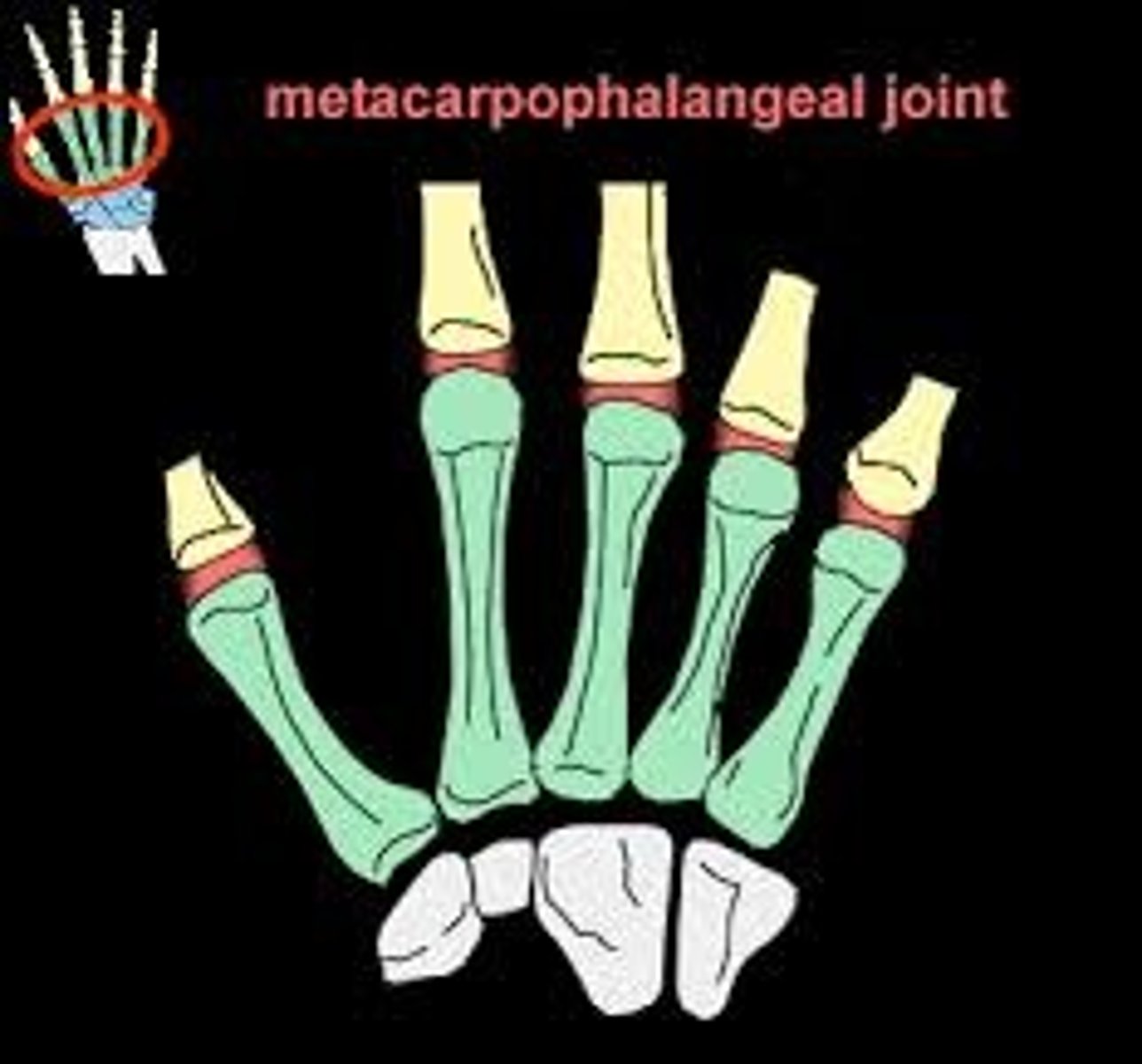 <p>Joint between metacarpals and phalanges.</p><p>Condyloid joint</p><p>- 2 degrees of freedom:</p><p>- Flexion/extension and abduction/adduction</p>