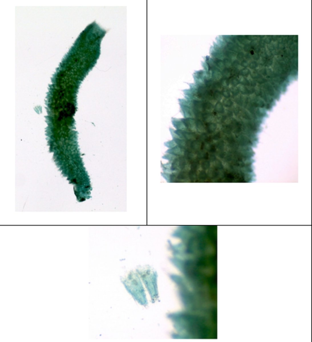 <p>Spicules that make up the lattice structure</p>