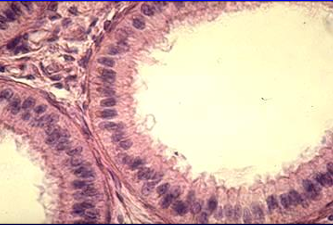 <p>Identify the structure:</p><p>Specie:</p><p>Lined by:</p>