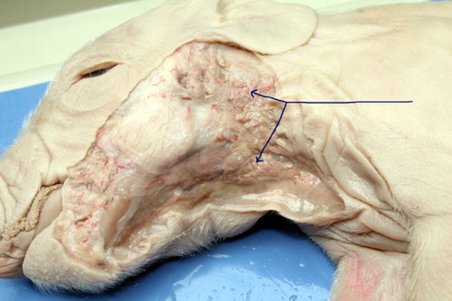 <p>largest salivary gland</p>