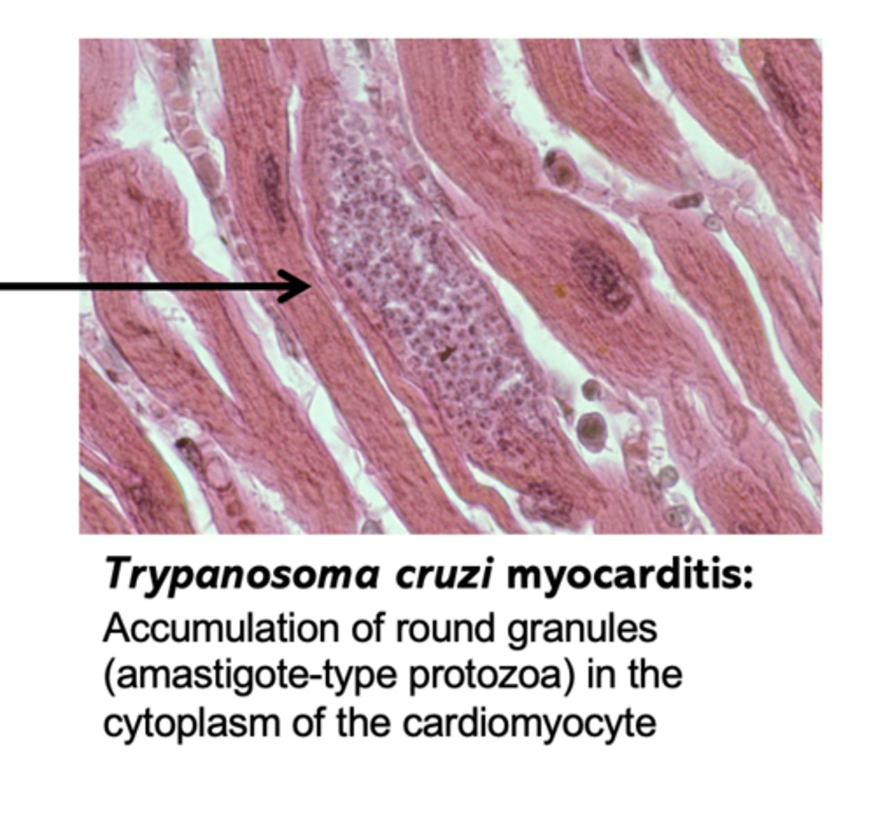 <p>when the parasites go intracellular, they lose their flagella and become amastigotes:</p>