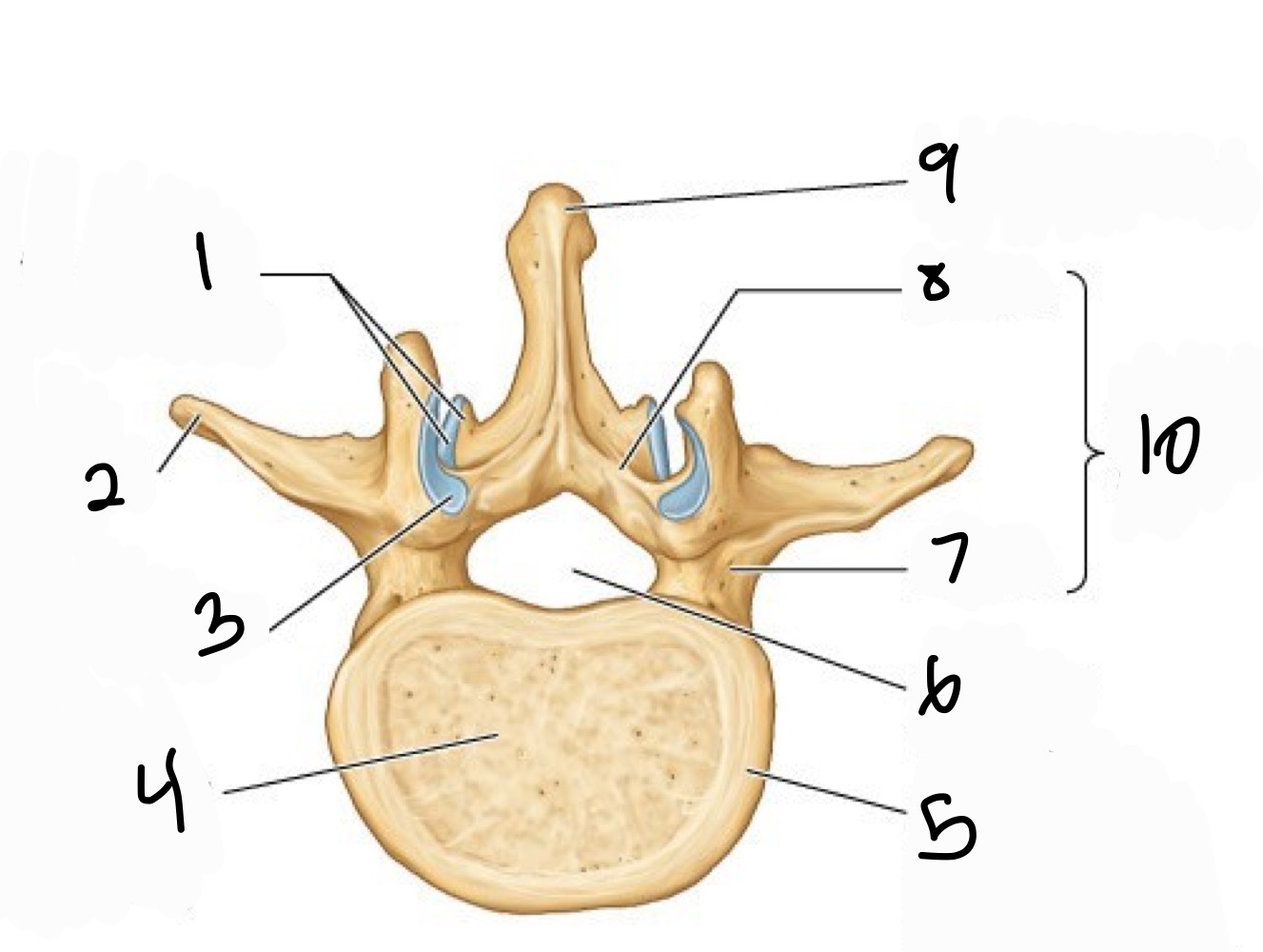 <p>1 inferior articular provess +facet</p><p>2 transverse process</p><p>3 sup articular facet</p><p>4 vertebral body (from centrum)</p><p>5 epipysial rim ( from arular epiphysis)</p><p>6 vertebral formanen</p><p>7 pedicle</p><p>8 Lamina</p><p>9 spinous process</p><p>10 vertebral arch</p>