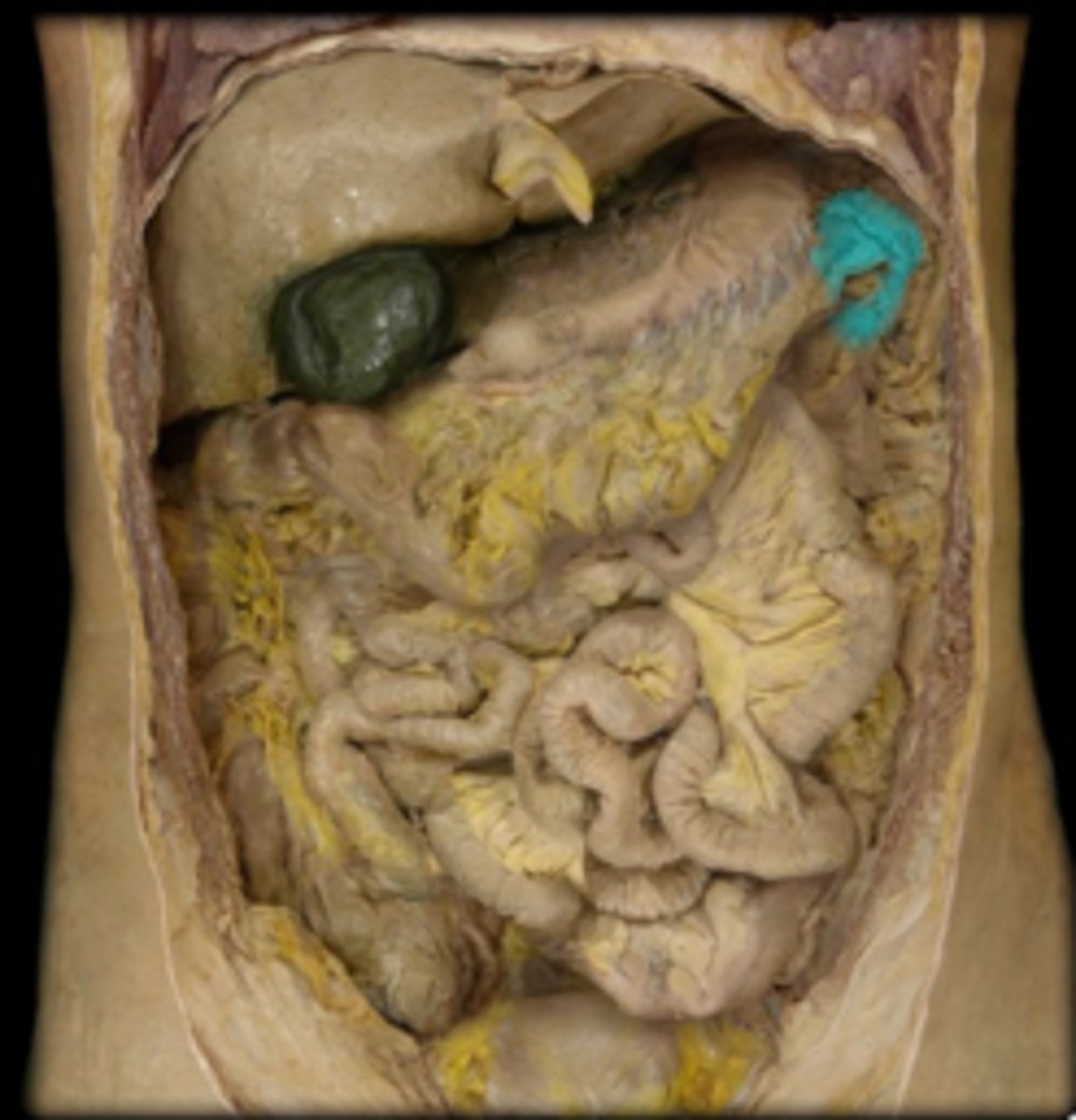 <p>Name this part of the large intestine. This is also known as the left colic flexture.</p>