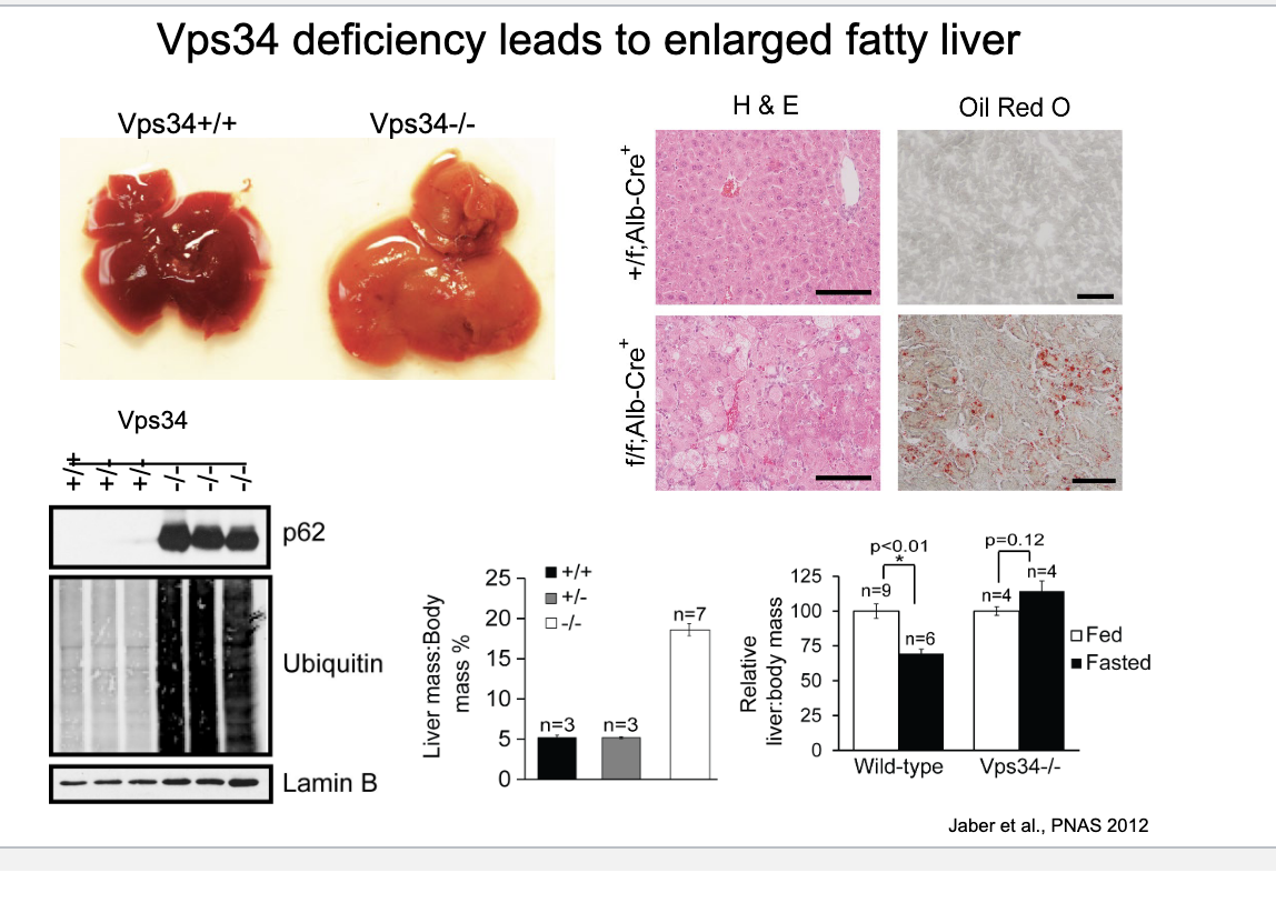 <ul><li><p>vps34 deficiency leads to enlarged fatty liver </p></li><li><p>deficient H&amp;E staining → clear structural disruption</p></li><li><p>oil red O staining → significant increase in red lipid drops → confirming fatty liver</p></li><li><p>western blot → VPS34 deficient show <strong>increased p62 and ubiquinated proteins</strong> → they are markers that are degraded via autophagy but since VPS34 is not really there they arent getting degraded</p></li><li><p>liver to body mass comparison in fed vs fasted</p><ul><li><p>normally, fasting <strong>decreases</strong> <strong>liver mass</strong> slightly due to increased autophagy mediated breakdown</p></li><li><p>VPS34-deficient animals fail to signifiantly reduce liver mass → impaired autophagy</p></li></ul></li><li><p>VPS34 = class III PI3K critical for starting autophagy → deficiency = NO autophagy</p></li></ul><p></p>