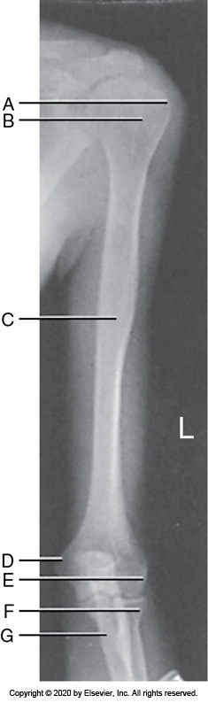 <p>Identify the labeled "D" anatomy in the image below:</p><p>Radial head</p><p></p><p>Greater tubercle</p><p>&nbsp;</p><p>Medial epicondyle</p><p>&nbsp;</p><p>Lateral epicondyle</p>