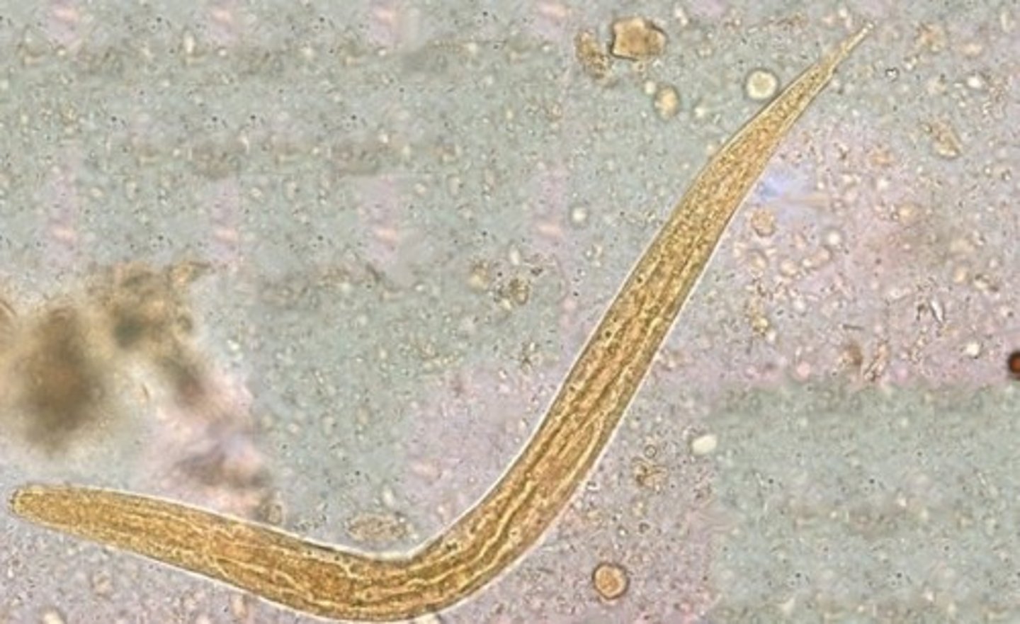<p>Study of parasites including helminths or parasitic worms.</p>